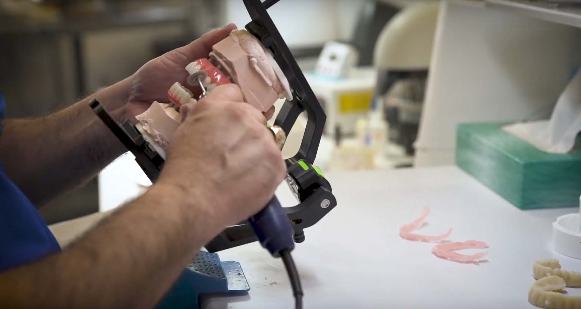The in-house dental laboratory at Implants 4 Life