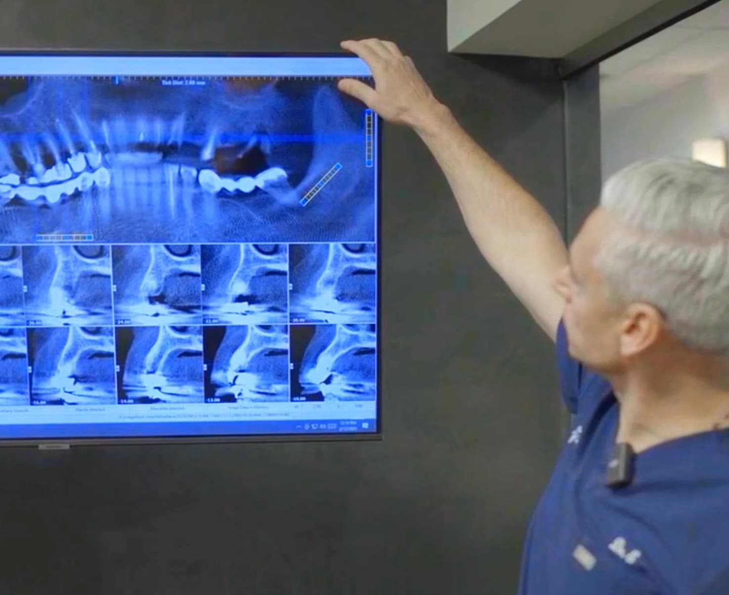 Dr. E reviewing dental X-rays during an implant evaluation.