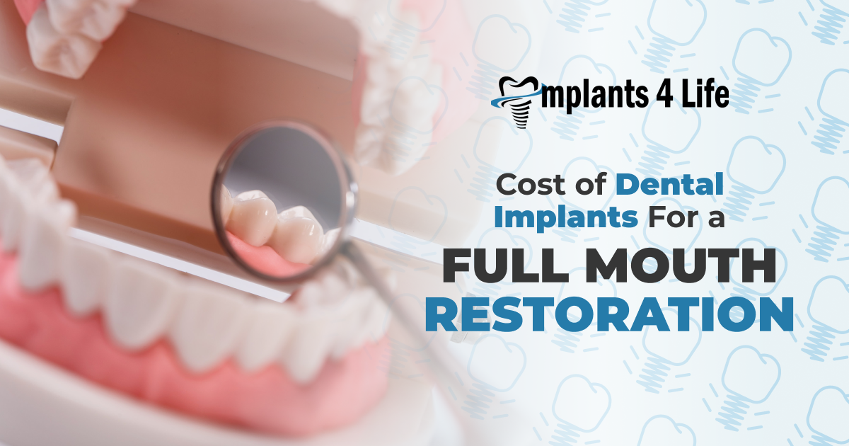 dental implants for a full mouth restoration