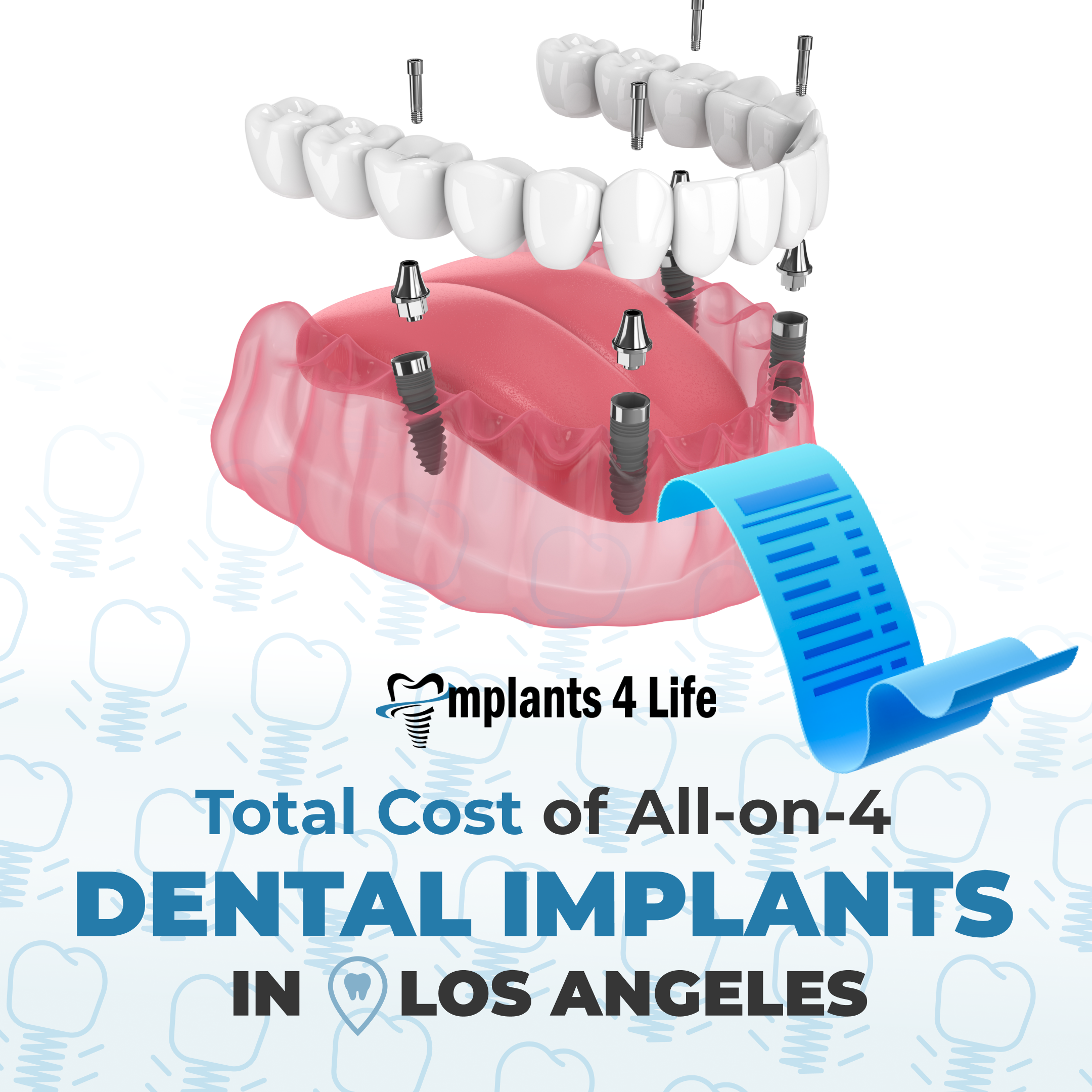 implants all on 4 cost