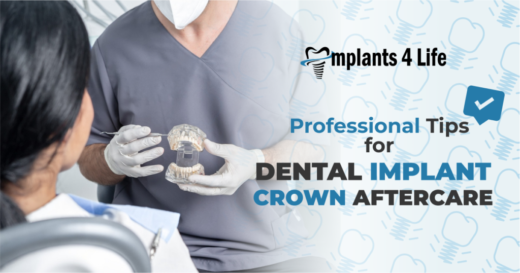 Dental Implant Crown Care 101 Professional Tips Implants4Life